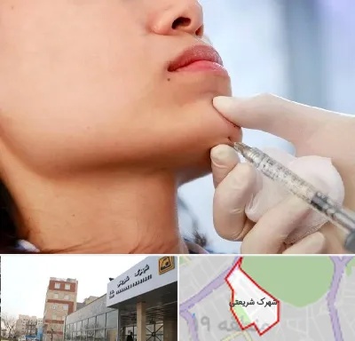 زاویه سازی صورت در شهرک شریعتی