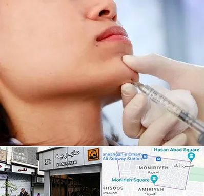 زاویه سازی صورت در منیریه 