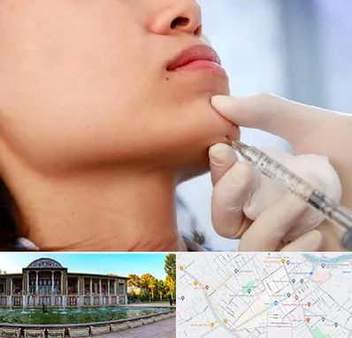 زاویه سازی صورت در عفیف آباد شیراز 