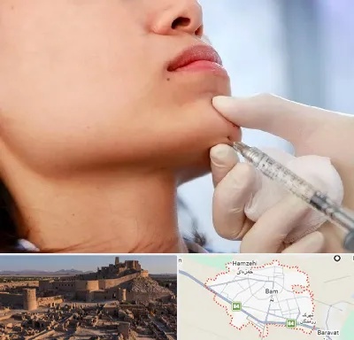 زاویه سازی صورت در بم