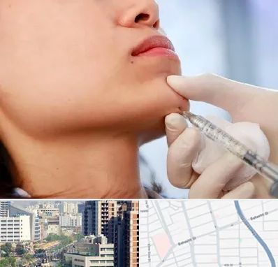 زاویه سازی صورت در خیابان بهشتی