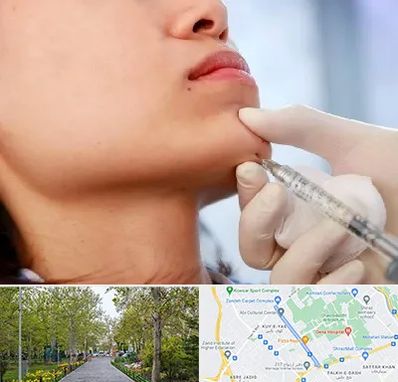 زاویه سازی صورت در قدوسی غربی شیراز 