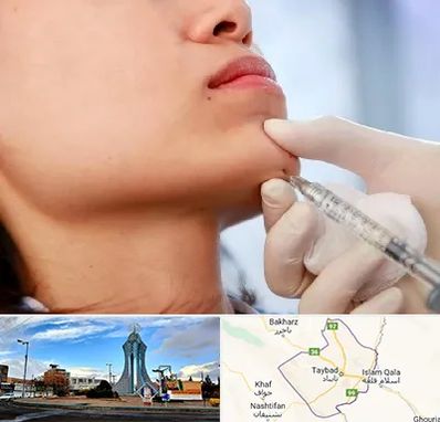 زاویه سازی صورت در تایباد