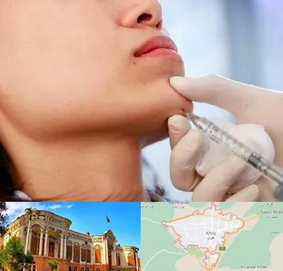 زاویه سازی صورت در خوی