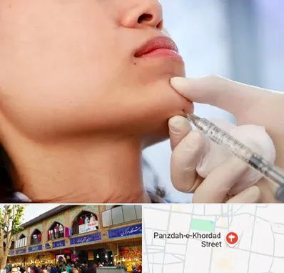 زاویه سازی صورت در 15 خرداد