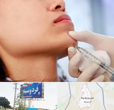 زاویه سازی صورت در فردوسیه شهریار