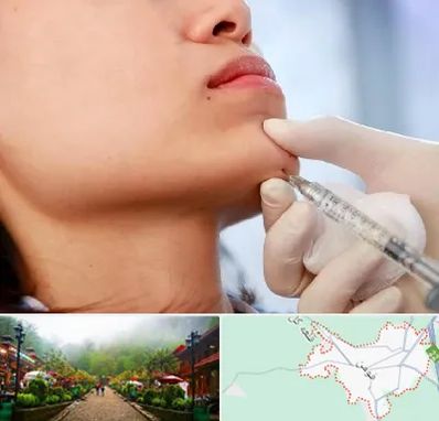 زاویه سازی صورت در فومن