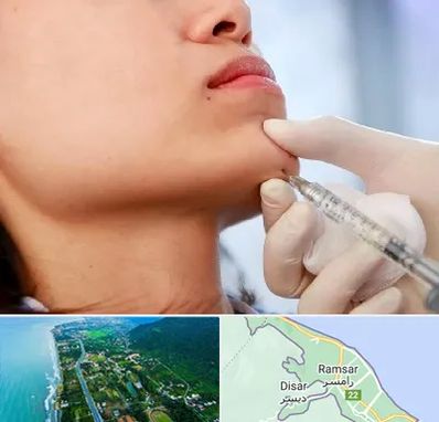 زاویه سازی صورت در رامسر