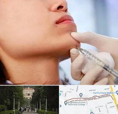 زاویه سازی صورت در بلوار معلم رشت 