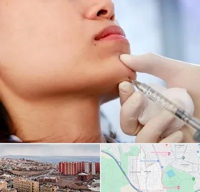 زاویه سازی صورت در سهند تبریز