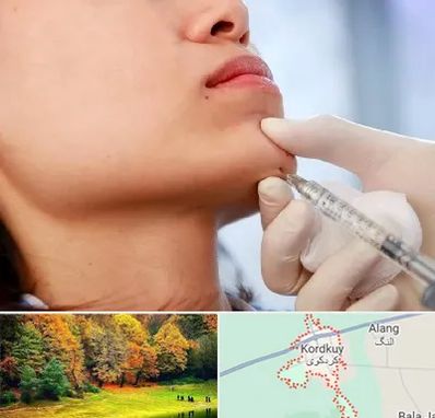 زاویه سازی صورت در کردکوی