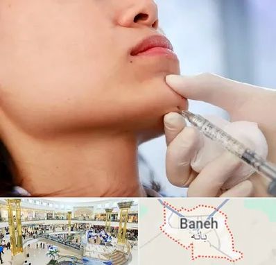 زاویه سازی صورت در بانه