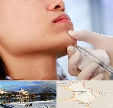 زاویه سازی صورت در ملایر