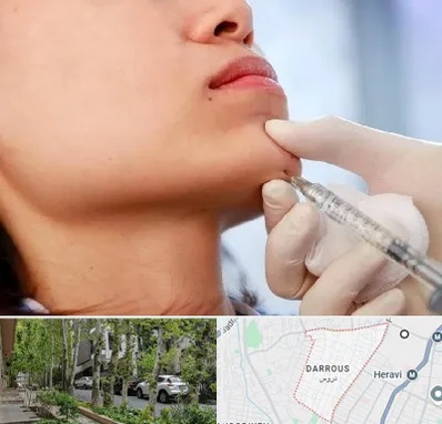 زاویه سازی صورت در دروس