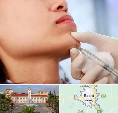 زاویه سازی صورت در رشت