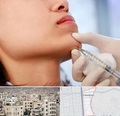 زاویه سازی صورت در اسکندری