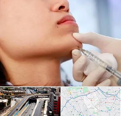 زاویه سازی صورت در ستارخان شیراز 