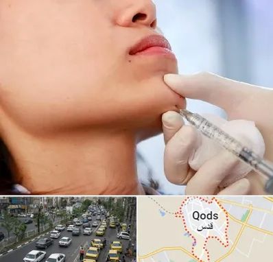 زاویه سازی صورت در شهر قدس