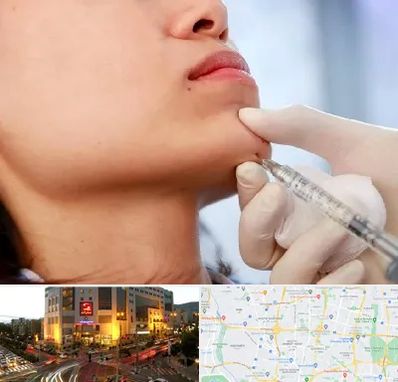 زاویه سازی صورت در جنت آباد تهران 