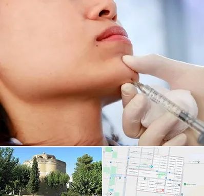 زاویه سازی صورت در مرداویج اصفهان 