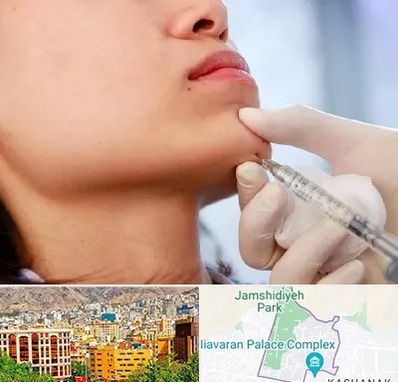 زاویه سازی صورت در نیاوران 