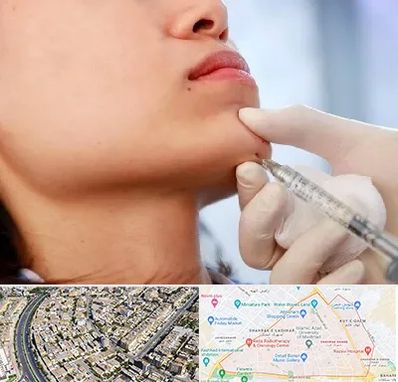 زاویه سازی صورت در شهرک غرب مشهد 