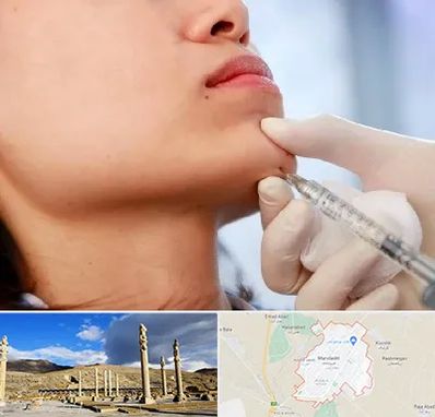 زاویه سازی صورت در مرودشت