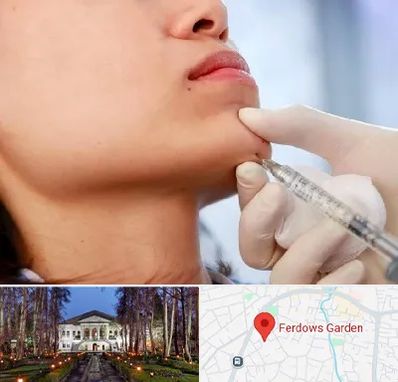 زاویه سازی صورت در باغ فردوس