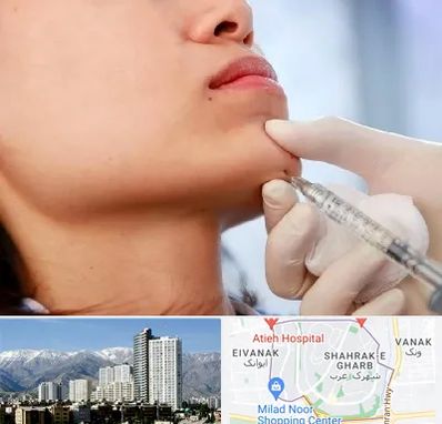 زاویه سازی صورت در شهرک غرب 