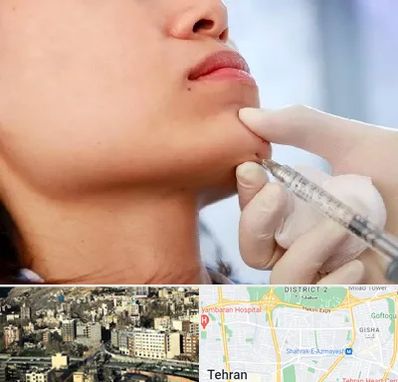 زاویه سازی صورت در مرزداران 