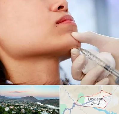 زاویه سازی صورت در لواسان