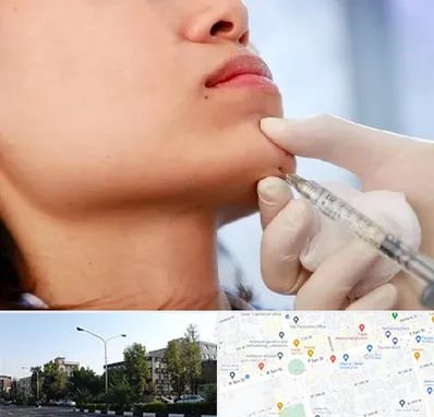 زاویه سازی صورت در میدان کاج 