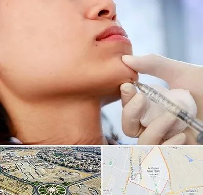 زاویه سازی صورت در اندیشه