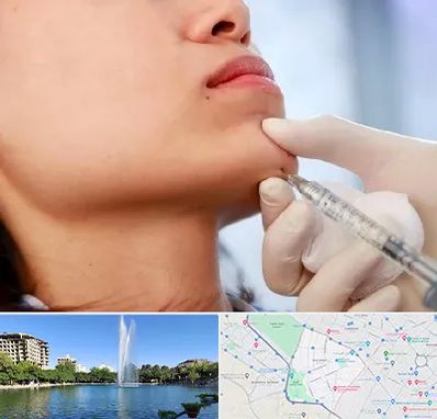 زاویه سازی صورت در کوهسنگی مشهد 