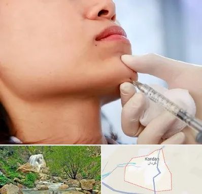 زاویه سازی صورت در کردان