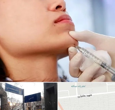 زاویه سازی صورت در سی متری جی