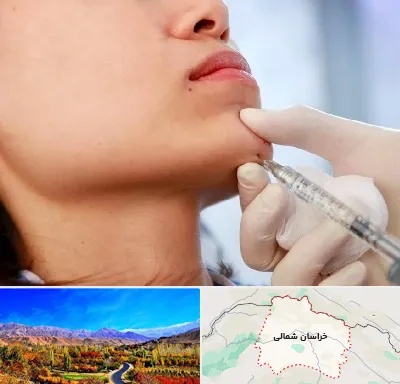 زاویه سازی صورت در خراسان شمالی