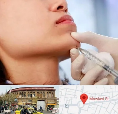 زاویه سازی صورت در مولوی