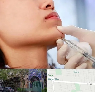 زاویه سازی صورت در بریانک