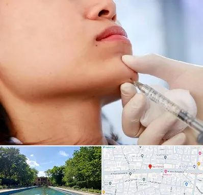 زاویه سازی صورت در هشت بهشت اصفهان 