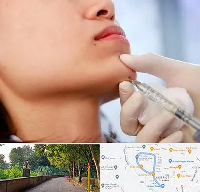 زاویه سازی صورت در فلکه گاز رشت 