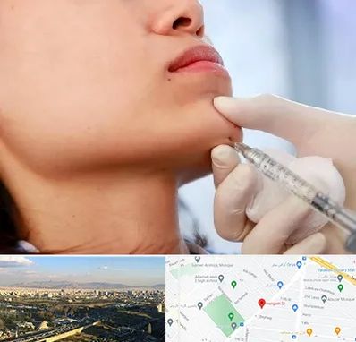 زاویه سازی صورت در هنگام 