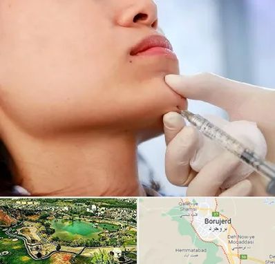 زاویه سازی صورت در بروجرد