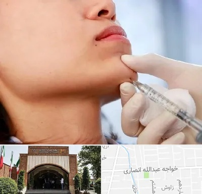 زاویه سازی صورت در خواجه عبدالله