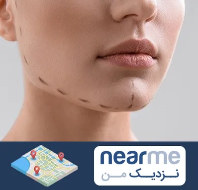 عمل زاویه فک در نزدیک من