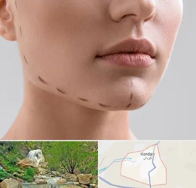 عمل زاویه فک در کردان