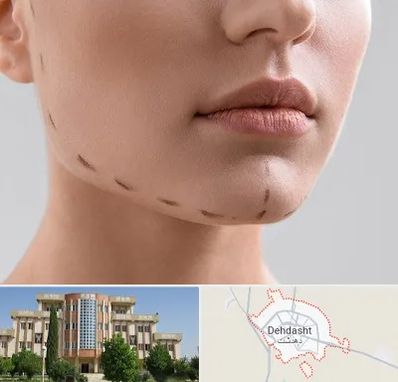 عمل زاویه فک در دهدشت