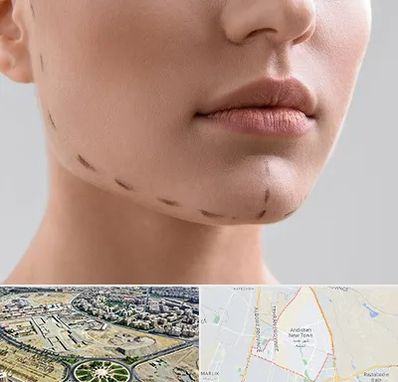 عمل زاویه فک در اندیشه