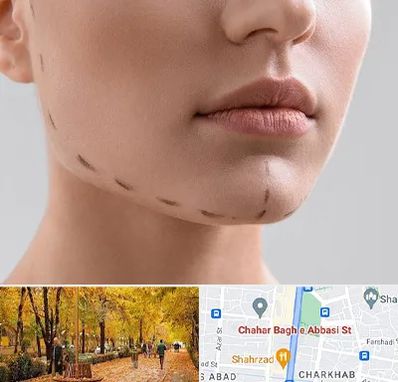 عمل زاویه فک در چهارباغ اصفهان