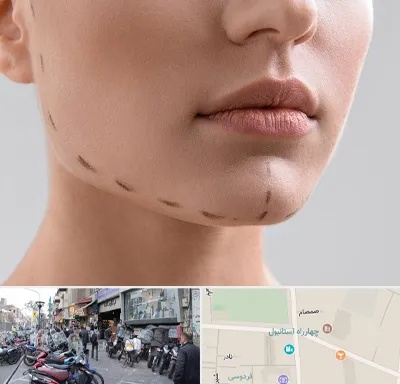 عمل زاویه فک در چهارراه استانبول